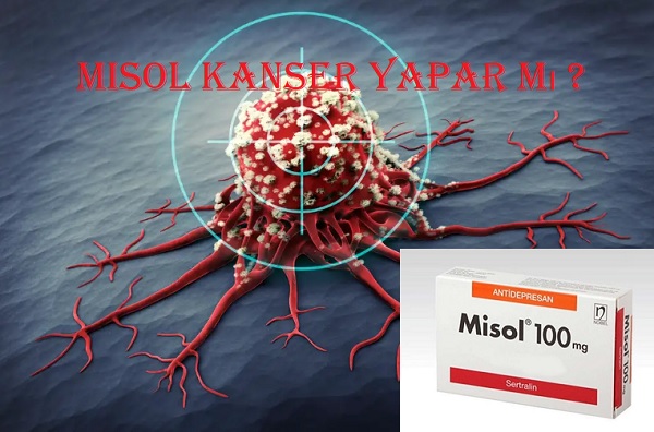 Misol kanser yapar mı